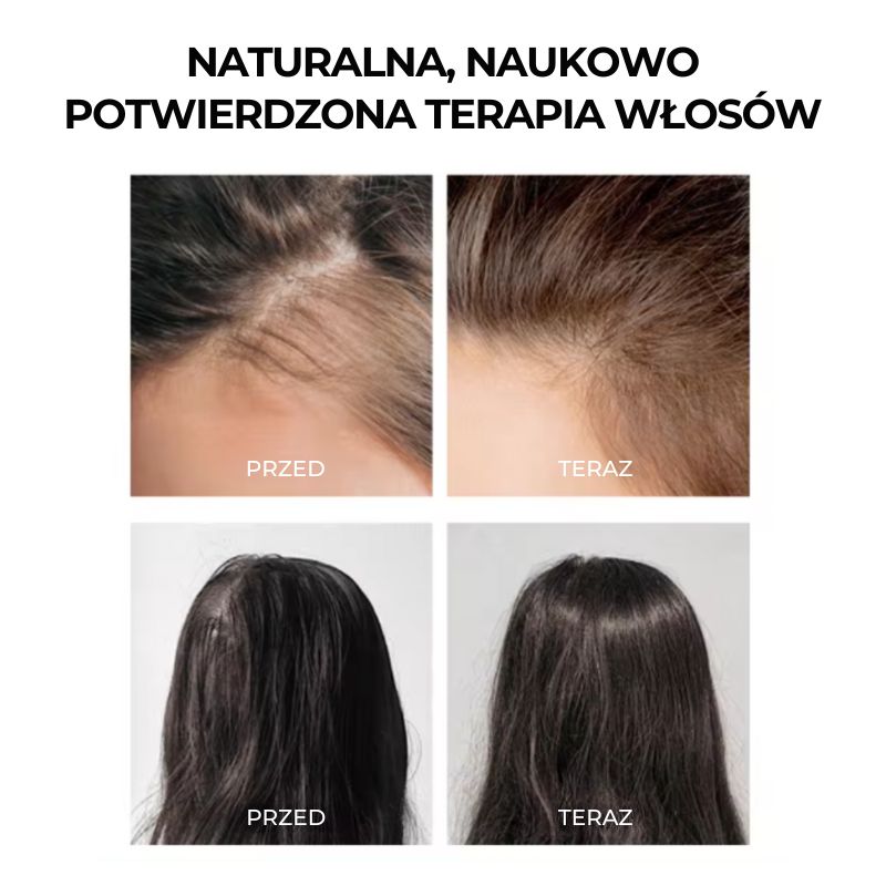 BoomHair™ - Silne i Gęste Włosy